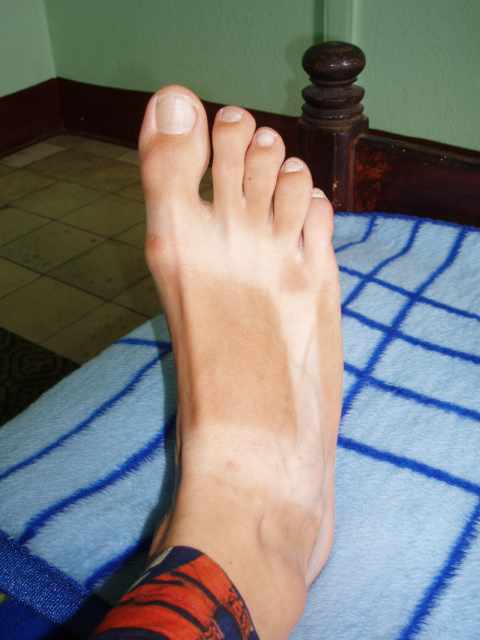 P8150184 : Bronzage TEVA